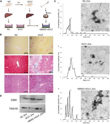 Potential Networks Regulated by MSCs in Acute-On-Chronic Liver Failure: Exosomal miRNAs and Intracellular Target Genes